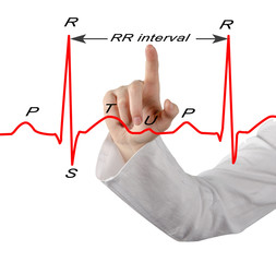 presenting marked ECG