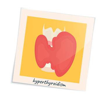 Thyroid gland disorder poster. Hyperthyroidism goiter symbol in a photo frame. Cute unhealthy internal body organ icon in cartoon style. Human endocrine system. Medical vector illustration.