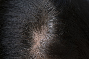 Young woman shows her gray hair roots, close up