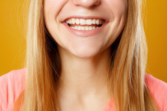 Close up picture of woman's teeth smiling