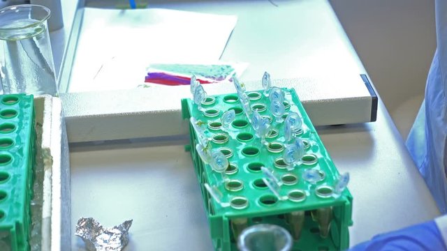 Researcher working at laboratory workplace for DNA test