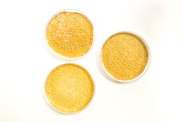 Culture of bacteria in petri dish