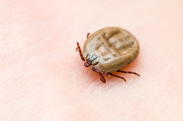 Encephalitis Virus or Lyme Disease or Monkey Fever Infected Tick Arachnid Insect on Skin