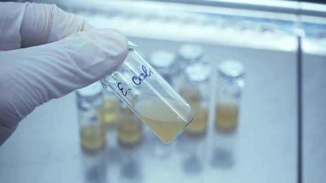 The scientist makes an analysis of the liquid culture of Escherichia coli. Culture Escherichia coli in a test tube close-up. Bacteria in liquid form in test tubes.