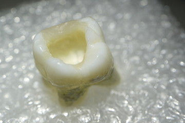 Picture of a human tooth.