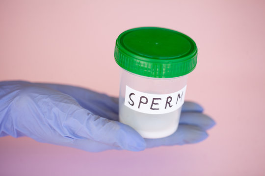 Health. Sperm Analysis. Concept of Bank Sperm. Infertility. Doctor's Hand Holding Container for Analyzes.