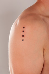 Kambo, frog medicine.