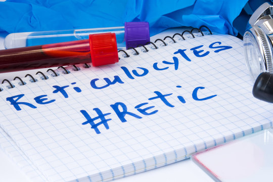 Reticulocytes count procedure (#Retic) blood test. Laboratory test tubes with blood, stethoscope, smear or film and gloves are near note with text Reticulocytes (#Retic) on table in doctor office
