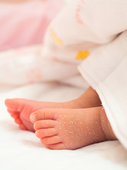 Closeup instep or foot of a newborn with a skin peeling on white cloth. Skin allergies in newborn called Vernix. the concept of health care and medical.