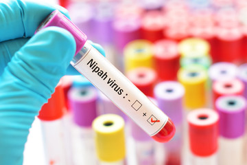 Fototapeta premium Blood sample tube positive with Nipah virus test