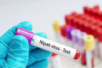 Fototapeta premium Test tube with blood sample for Nipah virus test 