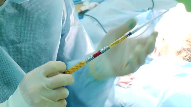 the doctor fills the syringe with human fat during a plastic surgery to rejuvenate the skin of a woman