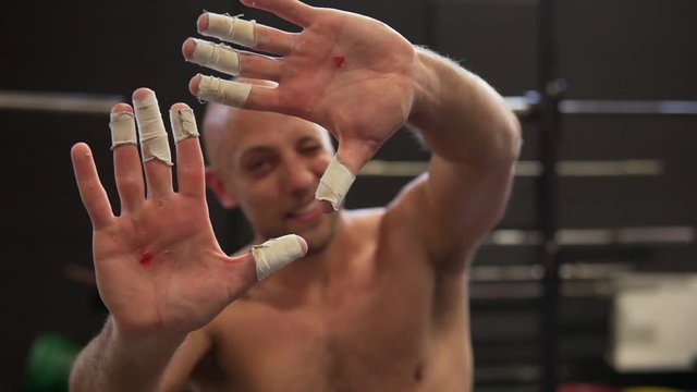 Fitness man showing hands with calluses and plasters on fingers after workout