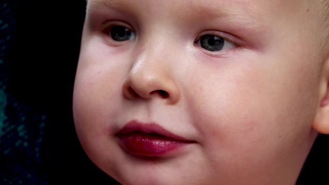 The boy has a broken wound on the lips