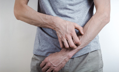 The concept of scabies. The man scratches his arm. Irritation. Drying of the skin.