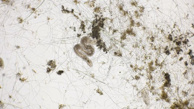 movement of the worm oligochaet under the microscope