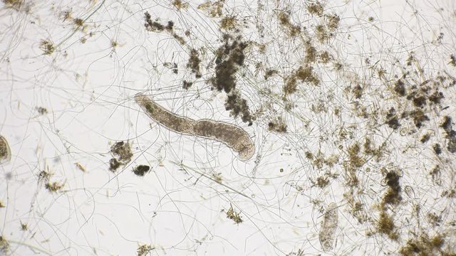 movement of the worm oligochaet under the microscope