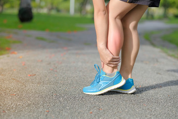 Young fitness woman holding his sports leg injury, muscle painful during training. Asian runner having calf ache and problem after running and exercise outside in summer