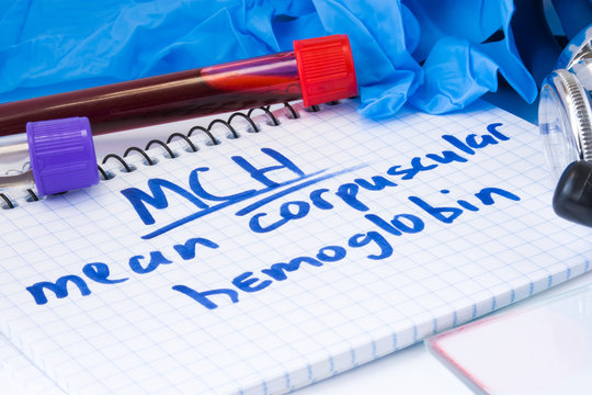 Mean corpuscular hemoglobin count procedure (MCH) blood test. Laboratory test tubes with blood, stethoscope, smear or film and gloves are near note with text MCH on table in doctor office