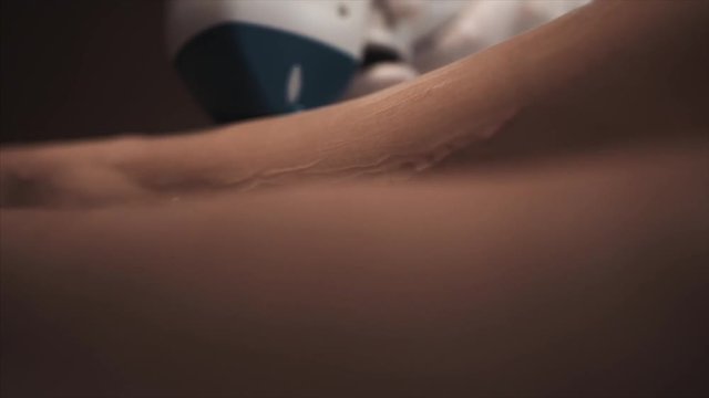 Doctor performing laser hair