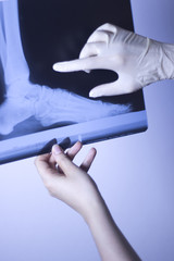 Medical xray foot scan