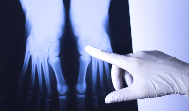 Medical Xray Foot Scan