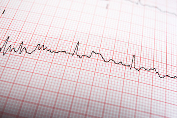 Electrocardiogram close up