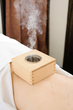 箱灸 Images Browse 9 Stock Photos Vectors And Video Adobe Stock