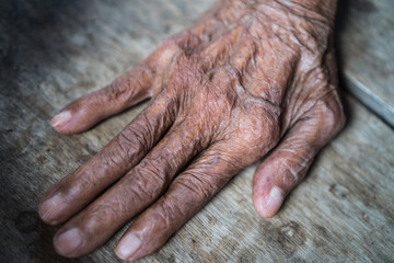 Old Asian female hands full of freckles and wrinkles / Aging concept