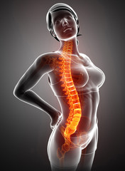 Women Feeling the Back pain