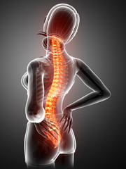 Women Feeling the Back pain