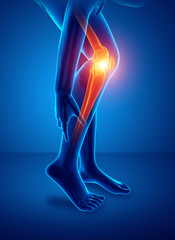 Male Knee pain