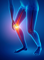 Women Knee joint pain