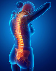 Women Feeling the Back pain