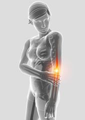 3d Illustration of Women Feeling Elbow pain