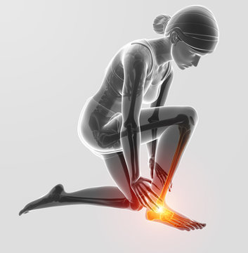 3d Illustration of Female foot with ankle pain