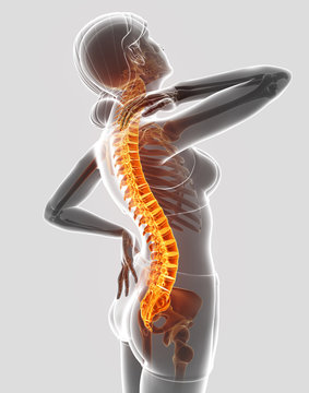 3D Illustration of Female Feeling the back pain
