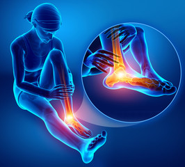 3d illustration of Female foot with ankle pain