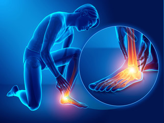 3d illustration of male foot with ankle pain