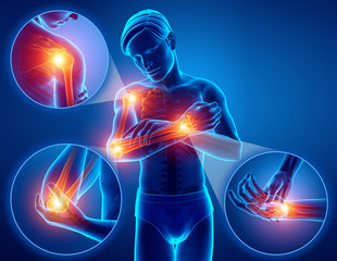 3d Illustration of Men Feeling Arm joint pain