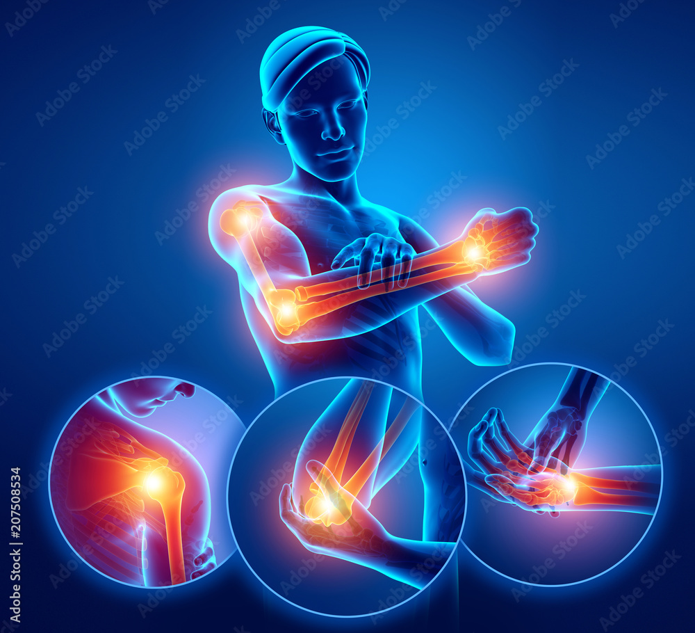 Wall mural 3d Illustration of Men Feeling Arm joint pain