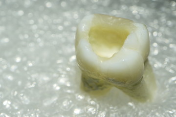 Picture of a human tooth.