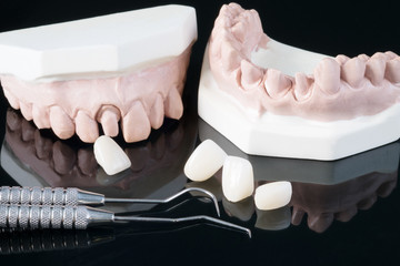 Crown and bridge equipment and model express fix restoration.