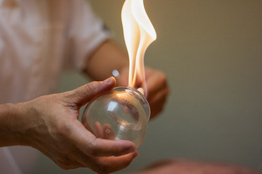 Woman preparing glass cup with flame for cupping therapy for pain relief