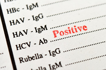 Laboratory report with hepatitis C virus positive test result