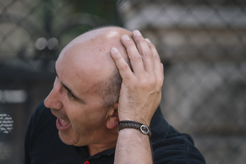Bald man shows his funny head.