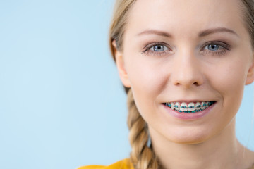 Woman showing her teeth with braces