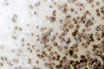 Rhizopus (bread mold) is a genus of common saprophytic fungi,Rhizopus (bread mold) under the microscope. 	