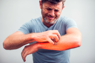 People scratch the itch with hand, Elbow, itching, Healthcare And Medicine, Men with skin problem...