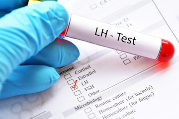 Blood sample tube with laboratory requisition form for luteinizing hormone (LH) test
